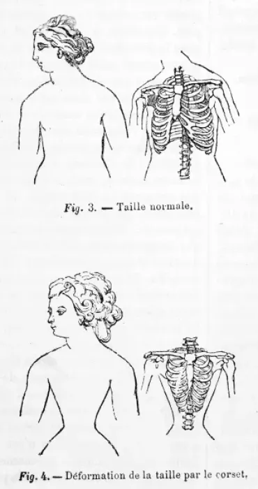 Stampa con cornice : Effetto dei gonnellini