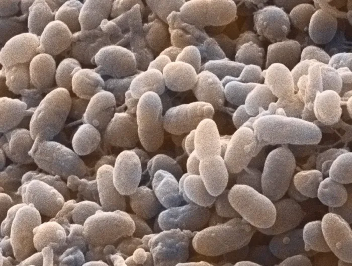 Stampa con cornice : Batteri Acetobacter, SEM
