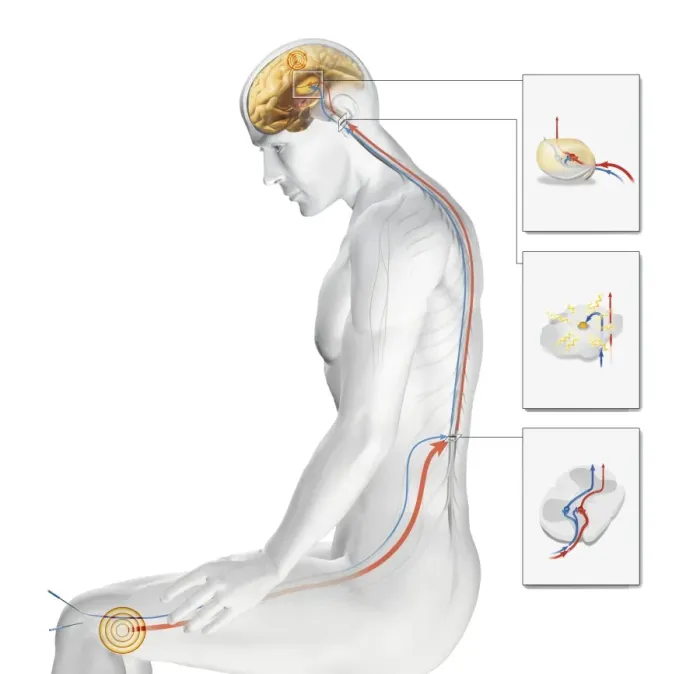 Stampa con cornice : Acupuncture Stampa con cornice : Acupuncture
