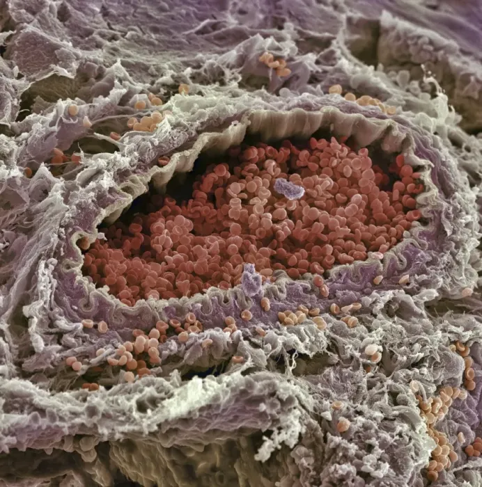 Stampa con cornice : Arteria SEM