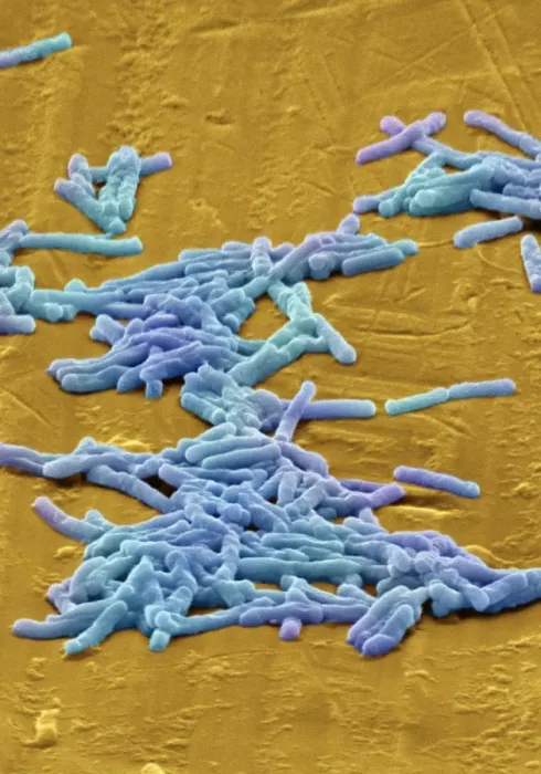 Stampa con cornice : Batteri Clostridium difficile, SEM Stampa con cornice : Batteri Clostridium difficile, SEM