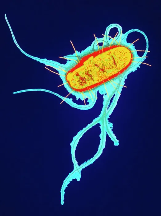 Stampa con cornice : Batterio E. coli