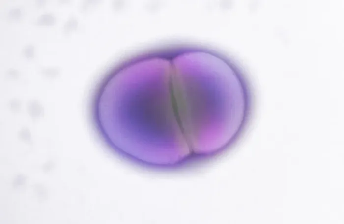 Stampa con cornice : L' Enterococcus faecalis si divide, TEM