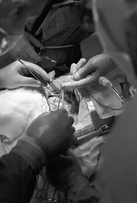 Stampa con cornice : Impiantando un pacemaker nucleare Stampa con cornice : Impiantando un pacemaker nucleare