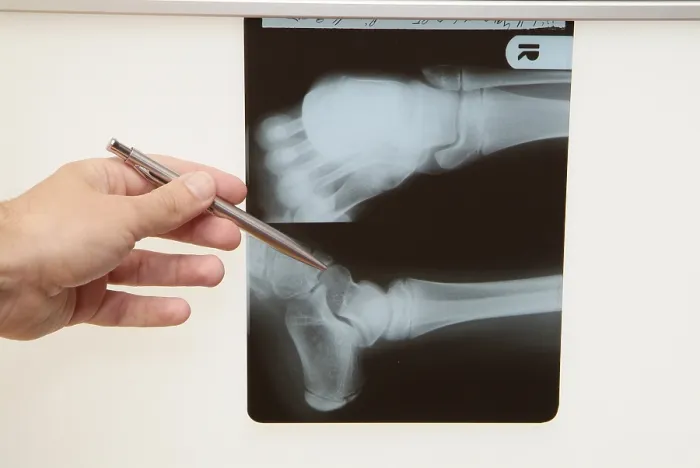 Stampa con cornice : Radiograph