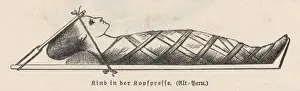 Historical Medical Equipment Stampe: Compression of Head