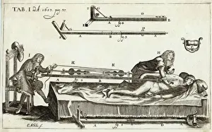 Medical Illustration Art Stampe: Setting a Bone 1682