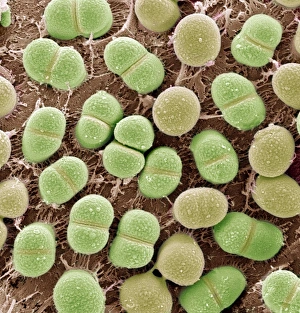 Coloured Scanning Electron Micrographs Stampe: Algae, SEM