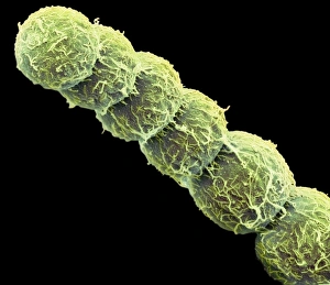 Immagini datate 1° novembre 2012: Alga di Anabaena