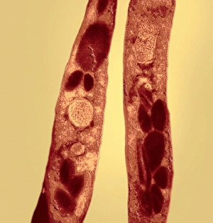 Transmission Electron Micrograph Stampe: Anthrax bacteria, TEM