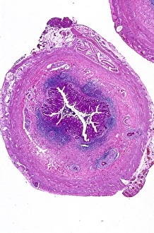 Stampe di Appendice. Microscopio luminoso di una sezione attraverso un appendice umano Immagini datate 2013 maggio: Appendice, fotografia a lente di ingrandimento leggera C016/0510