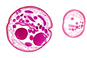 Light Micrograph Images Stampe: Ascaris roundworm, light micrograph