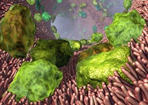 Stampe di Asthma. L'arte computazionale di gli allergeni (verde) nelle vie aeree dei polmoni. Gli allergeni, come la sporcizia e il polline, possono scatenare un attacco d'asma Immagini datate 2008 marzo: Astma, arte