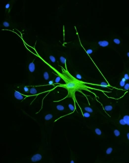 Stampe di L'astrocitio è una cellula nervosa. Microscopio a luce fluorescente di un astrocitio cellulare umano del cervello Immagini datate 2006 aprile: Celle nervose astrociite