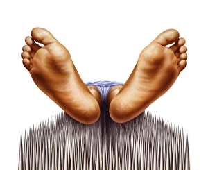 Alternative Healing Methods Stampe: Bed of nails, artwork