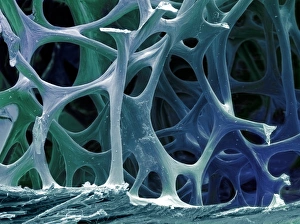 Stampe di Tissuto osseo di uccello. Micrografia elettronica colata colorata (SEM) della cancellosa (spongy) ossa del merlo Immagini datate 2009 giugno: Tessuto osseo delle uccelli, SEM