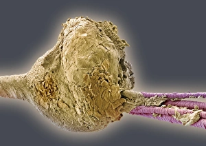 Stampe di Capo nero. Immagine di elettronica scalata colorato (SEM) delle ciocche che emergono da un blocco nella pelle Immagini datate 2004 settembre: Nodul de quinoa, SEM