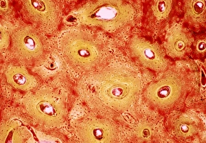 Human Bone Anatomy Stampe: Bone canals, light micrograph