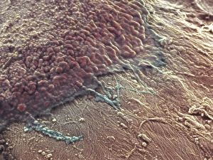 Coloured SEM Images Stampe: Bone reabsorption, SEM
