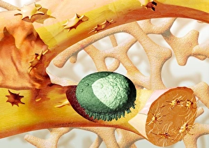 Stampe di La resorzione ossea. L'arte computazionale di un osteoclasto verde, cellule che rimuovono l'osso, distruggendo una piccola parte dell'osso Immagini datate 2004 settembre: Rossoluzione ossea