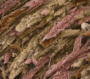 Stampe di Osso spugnoso. Micrografia a scansione elettronica colorata (SEM) di osso spugnoso congelato-frantumato Immagini datate 2001 ottobre: Ossa, SEM