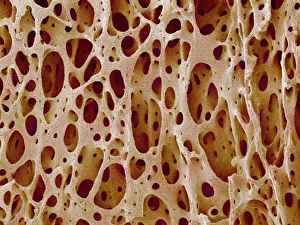 Stampe di Tissuto osseo. Immagine di raffreddamento elettronico colorato (SEM) della cancellosa (porosa). Il tissuto osseo può essere sia corticale (compattato), che cancelloso Immagini datate 2004 settembre: Tessuto osseo