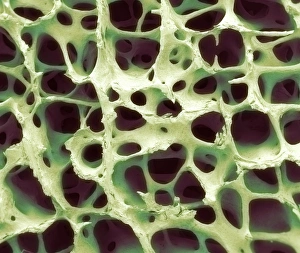 Cancellous Bone Structure Stampe: Bone tissue, SEM