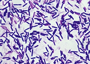 Stampe di Le batterie di Botulismo. Micrografia a luce debole delle batterie di botulismo (Clostridium botulinum). Queste batterie si verificano naturalmente nella terra Immagini del 5 marzo 2003: Batteria botulinica
