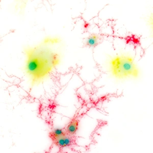 Brain Cell Structure Stampe: Brain cells, light micrograph