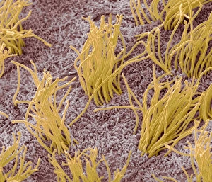 Stampe di La linea del cervello. Micrografia a raggi X di colore della linea interneurale, mostrando le barbe ciliegie (arancione) delle cellule ependimali Immagini datate 2012 marzo: Membrana cerebrale, SEM