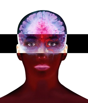 Nervous System Diagrams Stampe: Brain scan