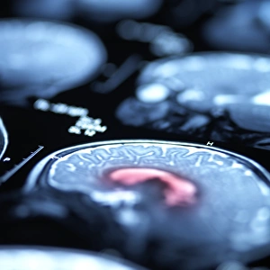Cerebral Cortex Structure Stampe: Brain scans