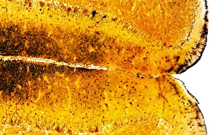 Light Microscopy Images Stampe: Brain tissue, light micrograph