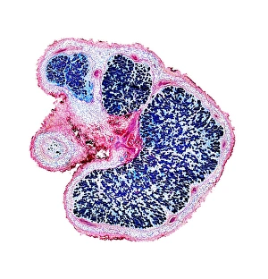 Light Microscopy Images Stampe: Broad bean root nodules, light micrograph