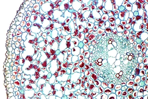 Vascular Bundle Structure Stampe: Buttercup stem, light micrograph