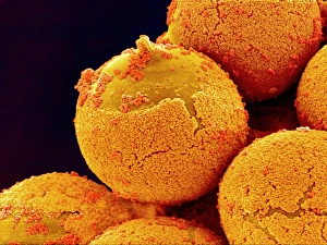 Pollen Grain Morphology Stampe: Cedar pollen, SEM