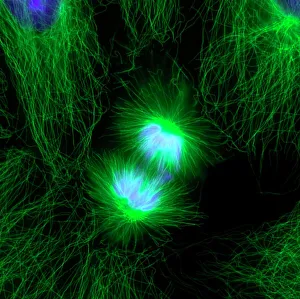 Stampe di La divisione cellulare. Micrografia fluorescente all'immuno con una fotografia di un epitelo umano (centro) durante la fase finale della fasi anafase del mitosi Immagini datate 2011 agosto: Divisione cellulare, fotografia a fluorescenza