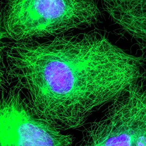 Stampe di La divisione cellulare. Micrografia fluorescente all'immuno con un epiteliale umano (centro) durante la fase interfase della mitosi Immagini datate 2011 agosto: Divisione cellulare, fotografia a fluorescenza