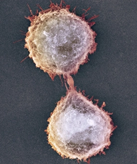 Stampe di La divisione cellulare. Immagine di raffreddamento elettronegativo colorato (SEM) di due cellule animali durante la cytokinesis (divisione cellulare) Immagini datate 2009 marzo: Divisio cellulare, SEM