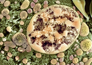 Nucleo cellulare, SEM