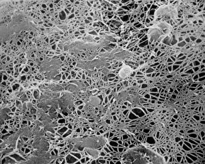 Immagini datate 1985: Fibroide micelle di cellulosa del muro cellulare