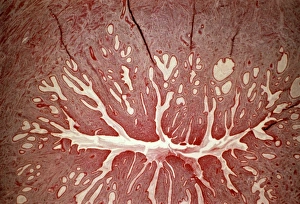 Female Reproductive System Anatomy Stampe: Cervix, light micrograph