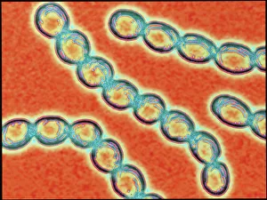 Stampe di Catene di batteri Streptococcus pyogenes Immagini del 26 marzo 2012: Cade di batteri Streptococcus pyogenes
