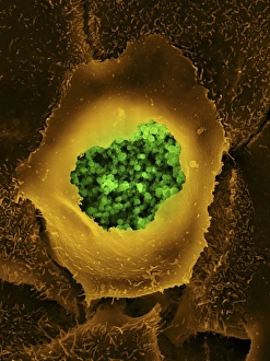 Coloured Scanning Electron Microscopy Stampe: Chlamydia, SEM