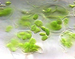 Photosynthesis Process Stampe: Chloroplasts, light micrograph