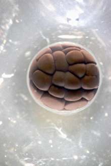 Cell Division Micrograph Stampe: Cleavage in frog egg, light micrograph