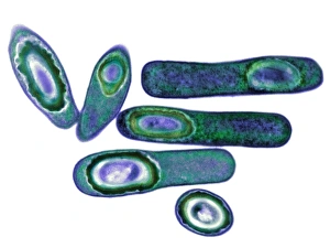 Antibiotic Resistant Bacteria Stampe: Clostridium difficile bacteria, TEM