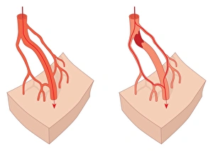 Circulatory System Artwork Stampe: Collateral circulation, artwork