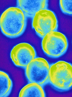 Immagini del 19 agosto 2003: Bacchio colorato di Halococcus