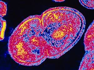 Stampe di Enterococcus faecalis. Micrografia elettronica a trasmissione colorata (TEM) di Enterococcus faecalis batterio (precedentemente noto come Streptococcus faecalis) Immagini datate 1994: Microscopia elettronica a contrasto di colore di Enterococcus faecalis.